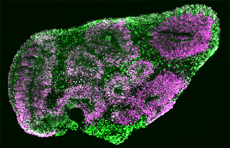 Immunostaining of iNSCs