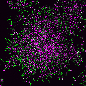 Immunostaining of iNSCs